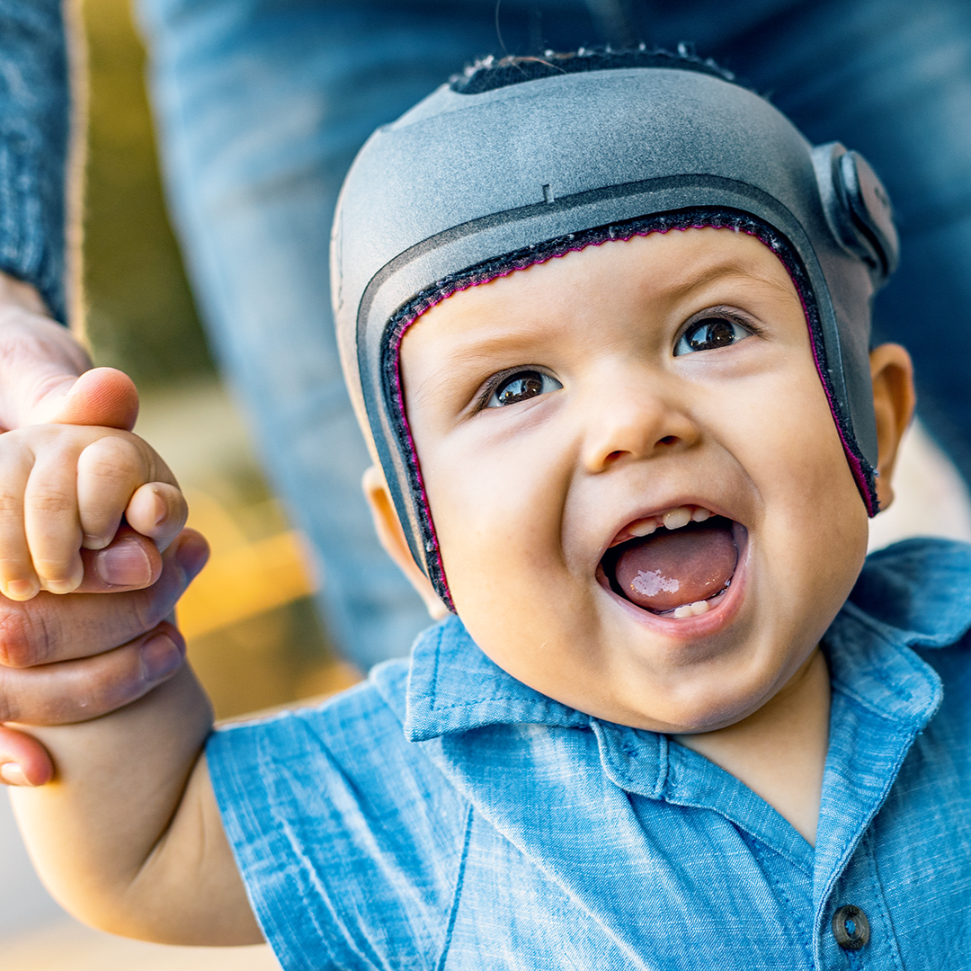 Baby mit wachstumslenkender Kopforthese MyCRO Band von Ottobock